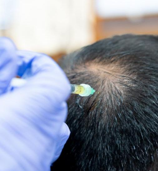 prp-behandling i göteborg