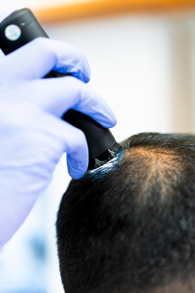 utredning av håravfall