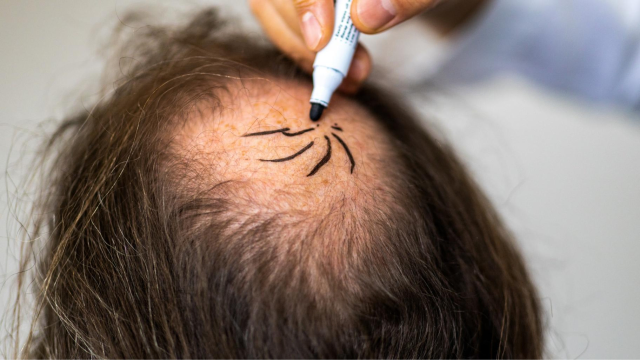 prp-behandling i göteborg