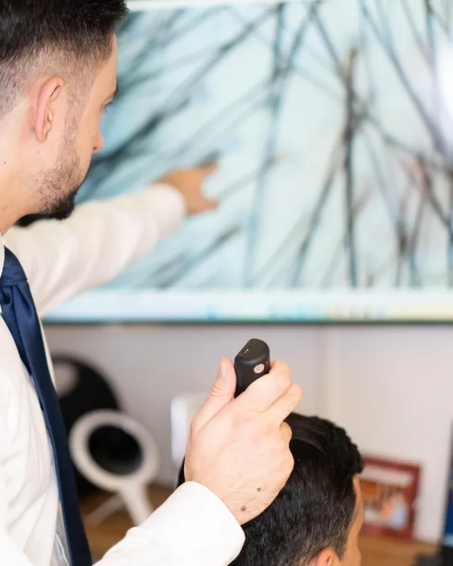 hårtransplantation göteborg