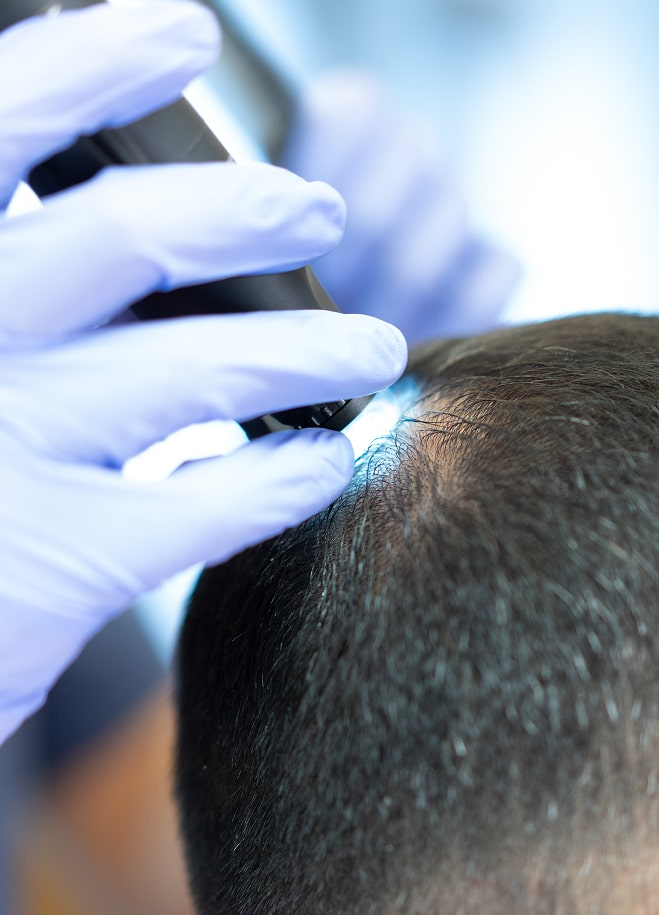 hårklinik i göteborg